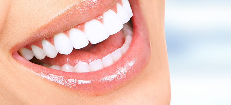 Top Food for Natural Teeth Whitening