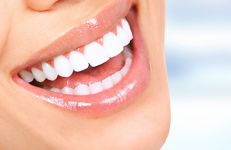 Top Food for Natural Teeth Whitening
