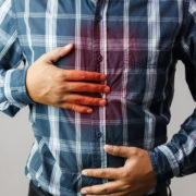 Finding the Best Acid Reflux Treatment