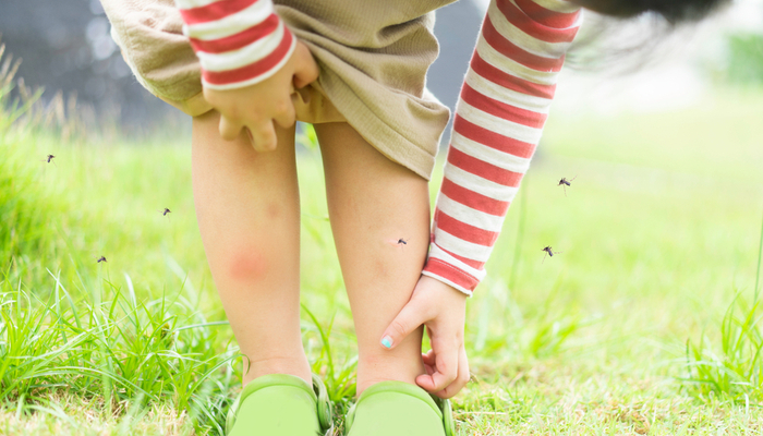 Buzz Off: Stopping Mosquitoes from Ruining Your Summer Fun