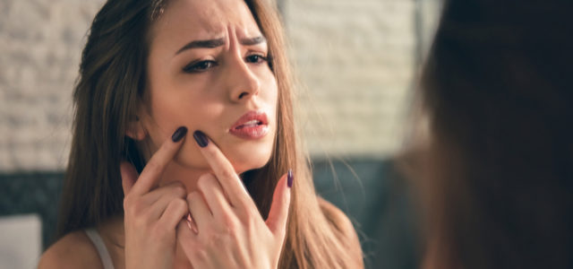 Your Acne-Prone Skin is Begging You to Read This