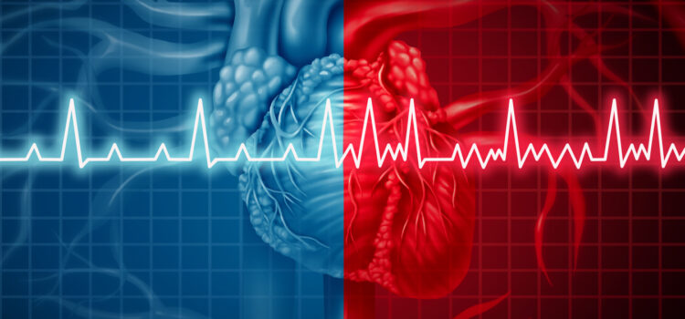 Atrial Fibrillation and Strokes: What you Need to Know