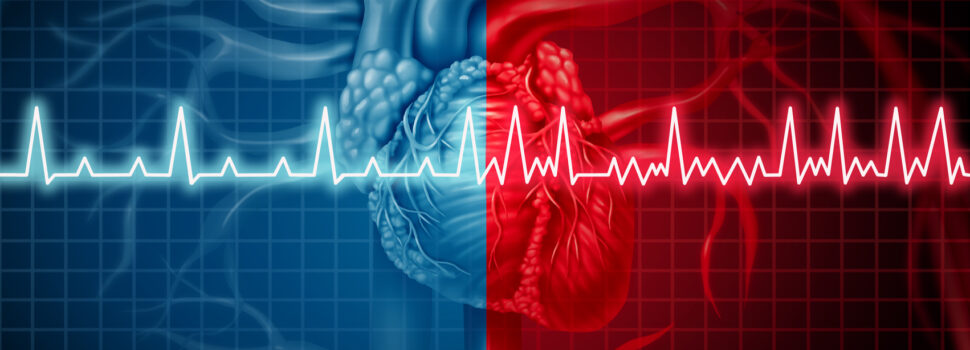 Atrial Fibrillation and Strokes: What you Need to Know