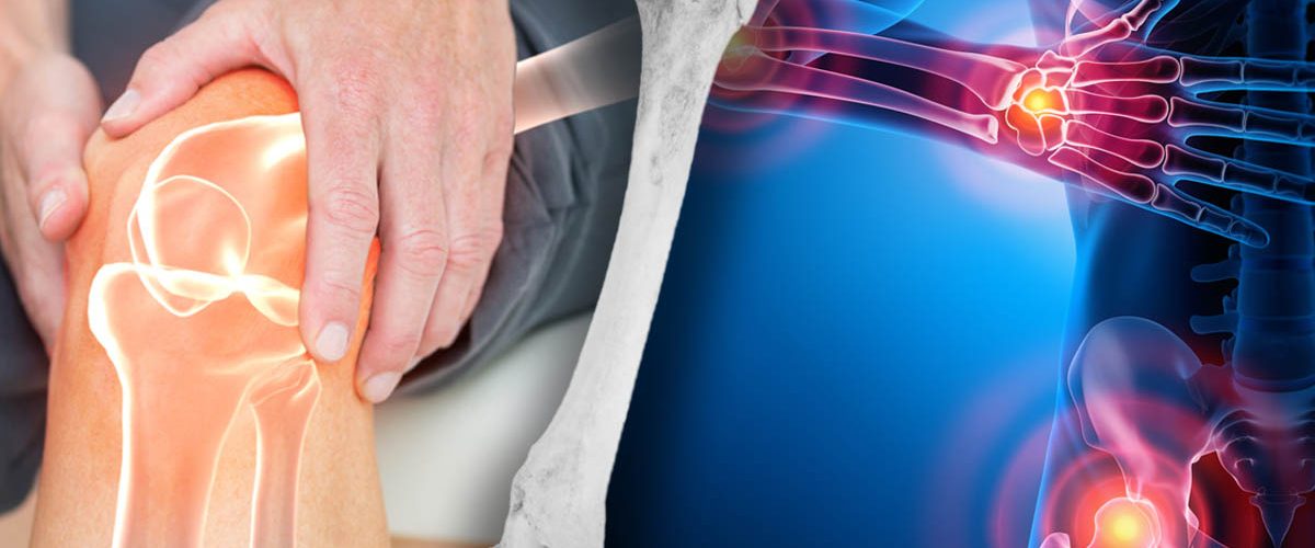 The Unbelievably Simple Tricks to Banishing Arthritis Pain For Good